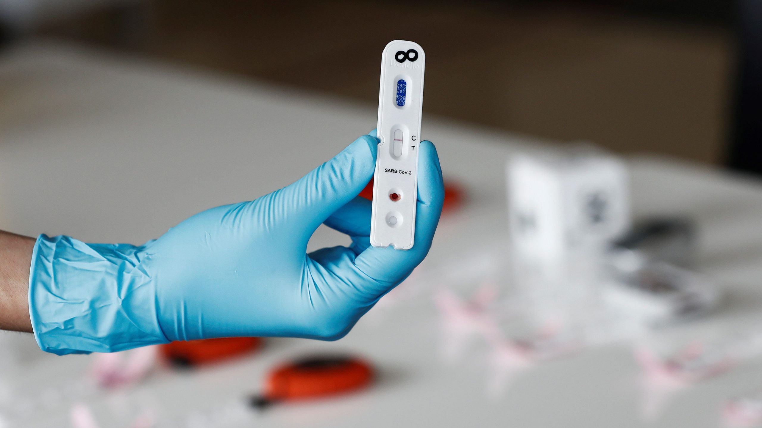 España hará en octubre otro estudio de seroprevalencia después de que haya sumado 300.000 contagios desde junio