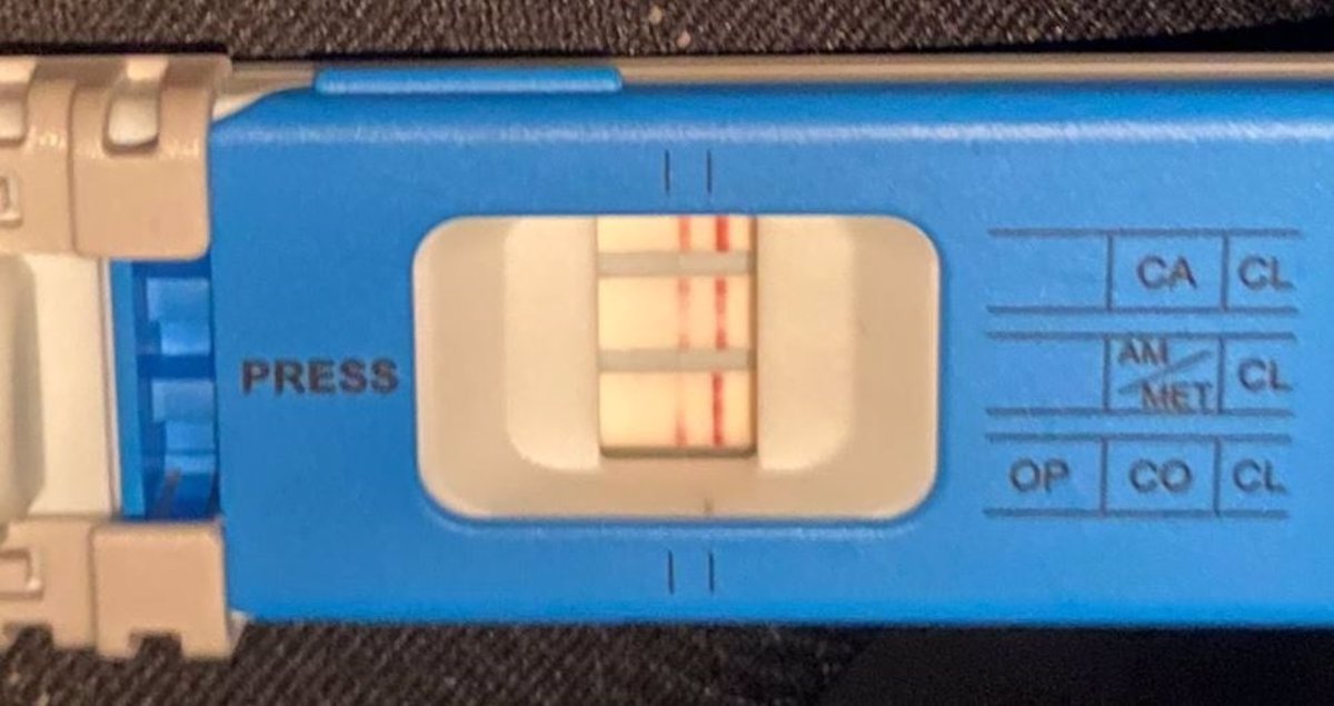 NAVARRA. Un conductor adelanta a un coche policial a casi 200 km/h y da positivo en drogas